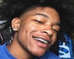 He used braces to correct his teeth.